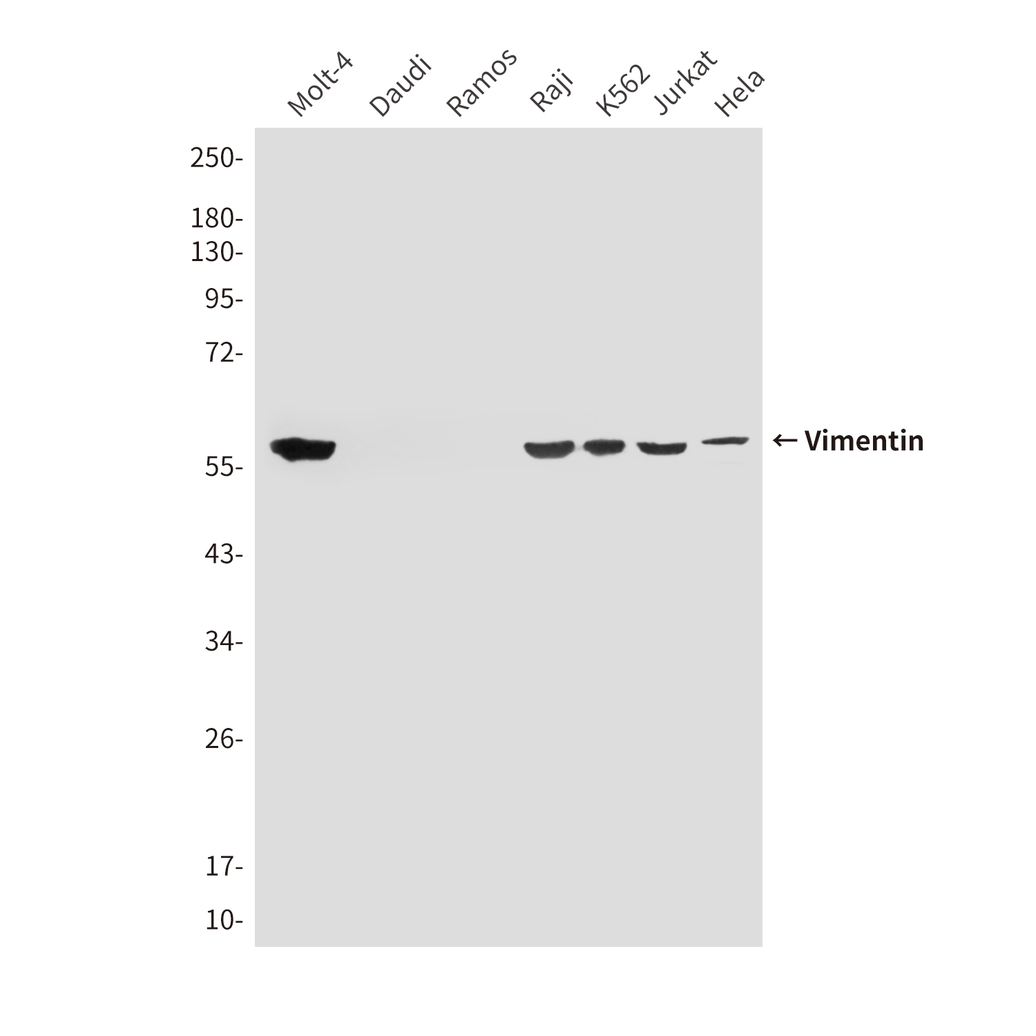Mouse Monoclonal Antibody to Vimentin