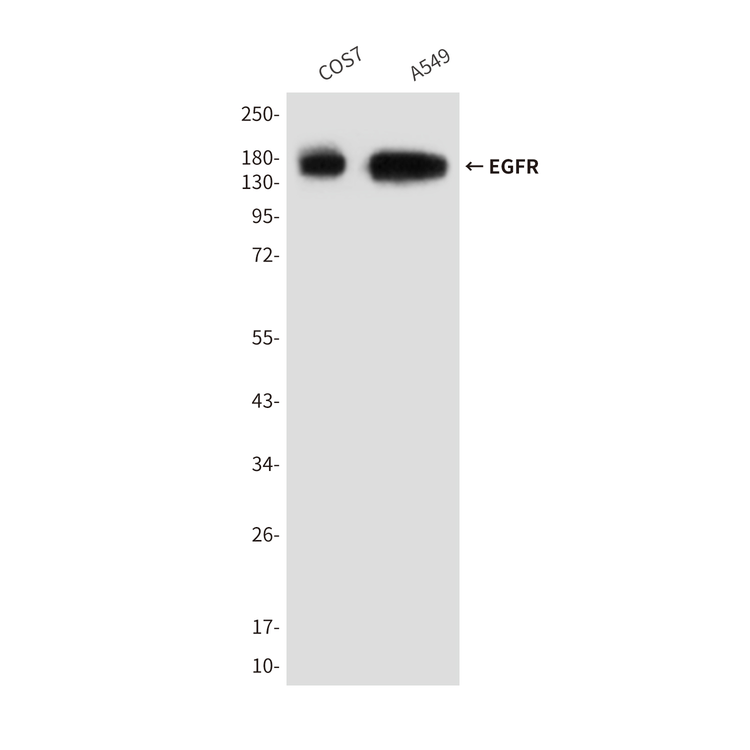 Mouse Monoclonal Antibody to EGFR