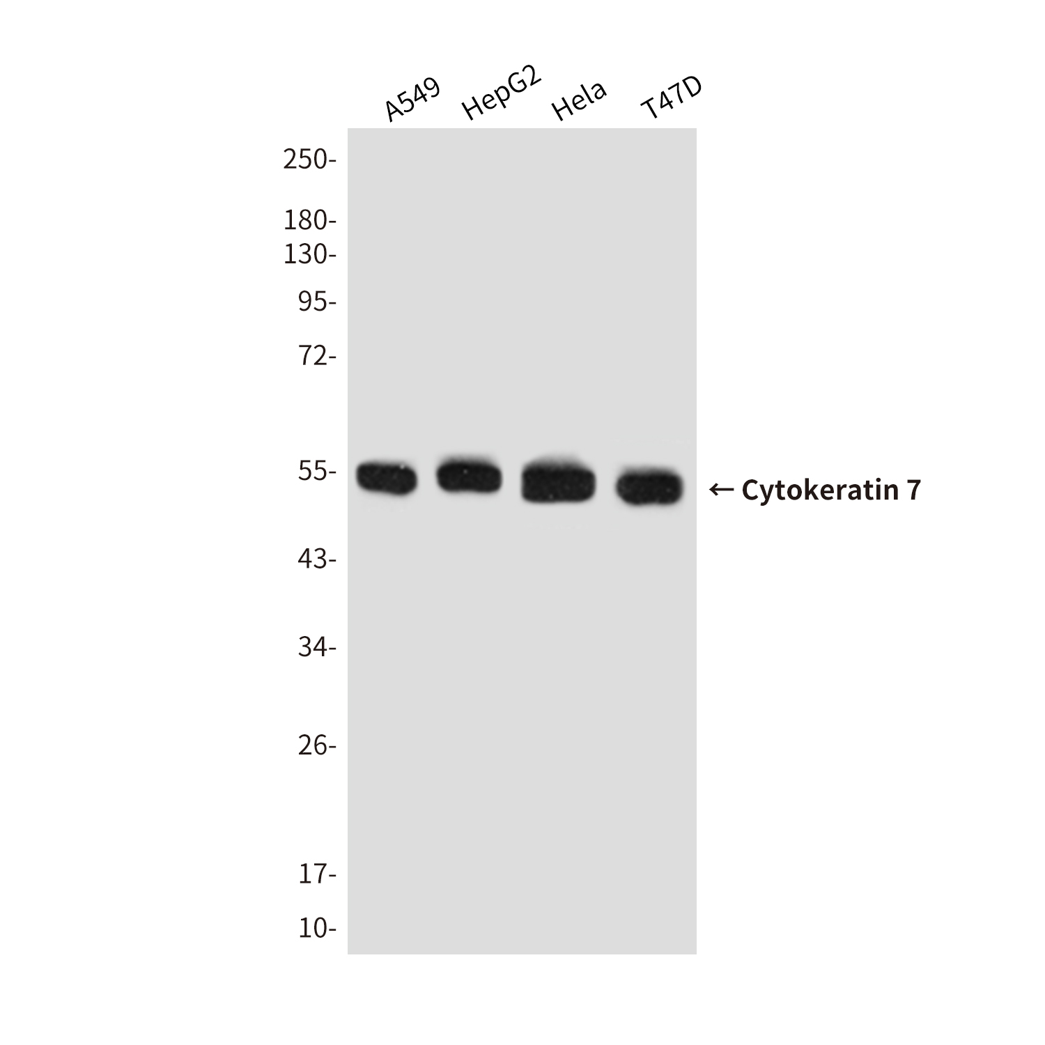 Mouse Monoclonal Antibody to Cytokeratin 7