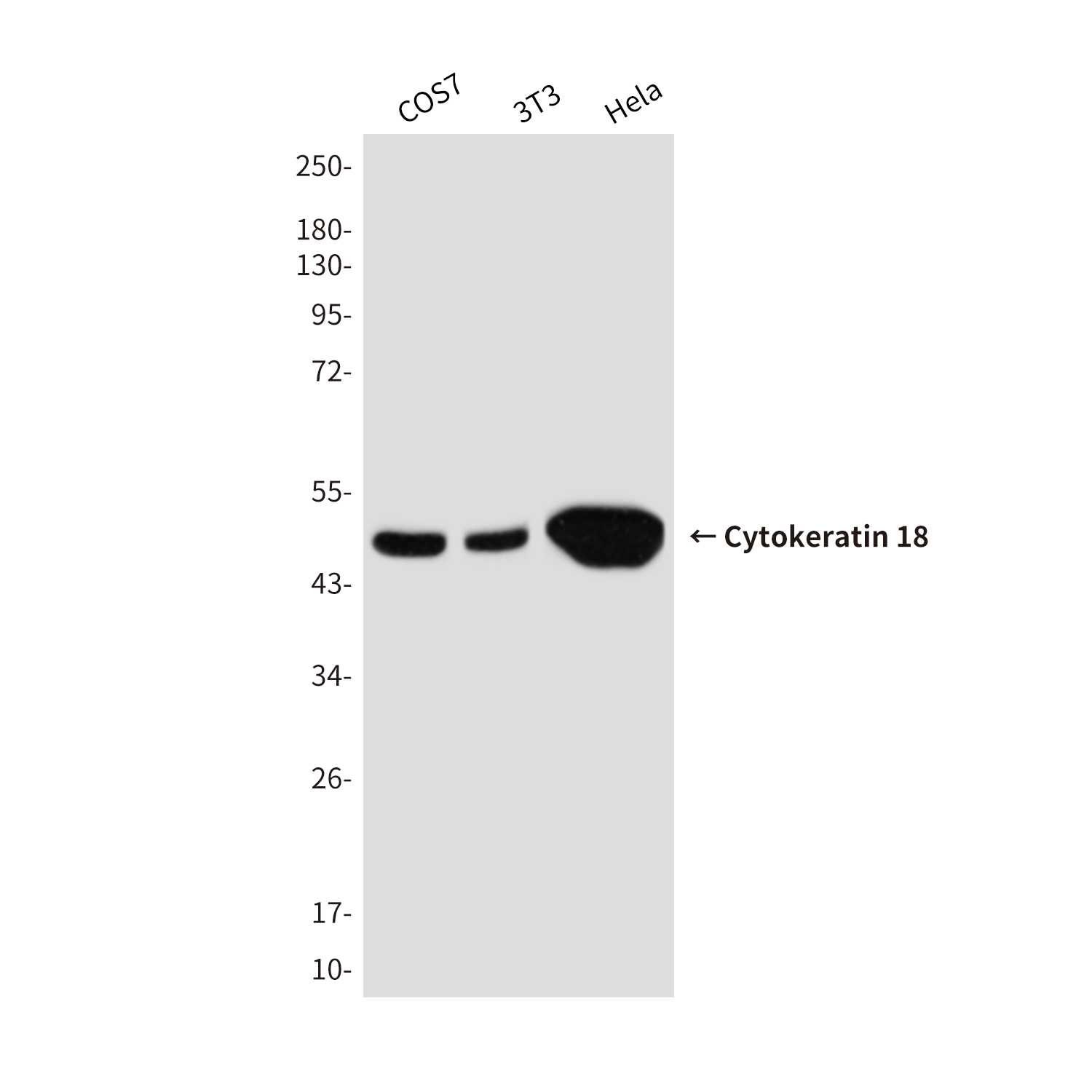 Mouse Monoclonal Antibody to Cytokeratin 18