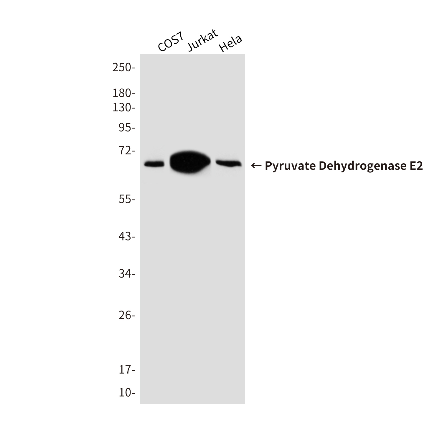 Mouse Monoclonal Antibody to Pyruvate Dehydrogenase E2
