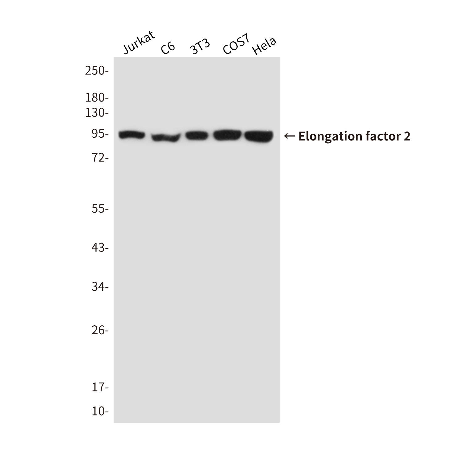 Mouse Monoclonal Antibody to Elongation factor 2