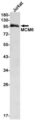 Rabbit Monoclonal Antibody to MCM6