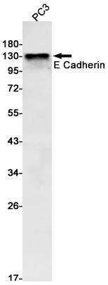 Rabbit Monoclonal Antibody to E Cadherin