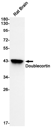 Rabbit Monoclonal Antibody to Doublecortin