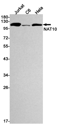Rabbit Monoclonal Antibody to NAT10