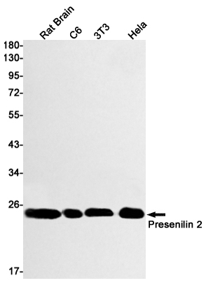 Rabbit Monoclonal Antibody to Presenilin 2