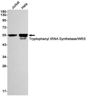 Rabbit Monoclonal Antibody to Tryptophan tRNA Ligase