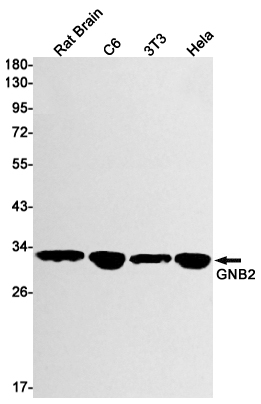 Rabbit Monoclonal Antibody to GNB2