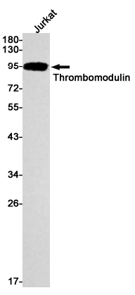 Rabbit Monoclonal Antibody to Thrombomodulin