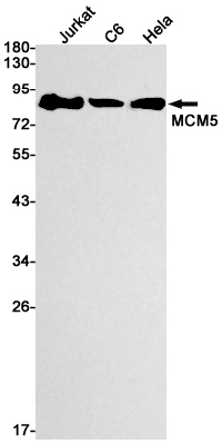 Rabbit Monoclonal Antibody to MCM5