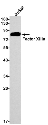 Rabbit Monoclonal Antibody to Factor XIIIa