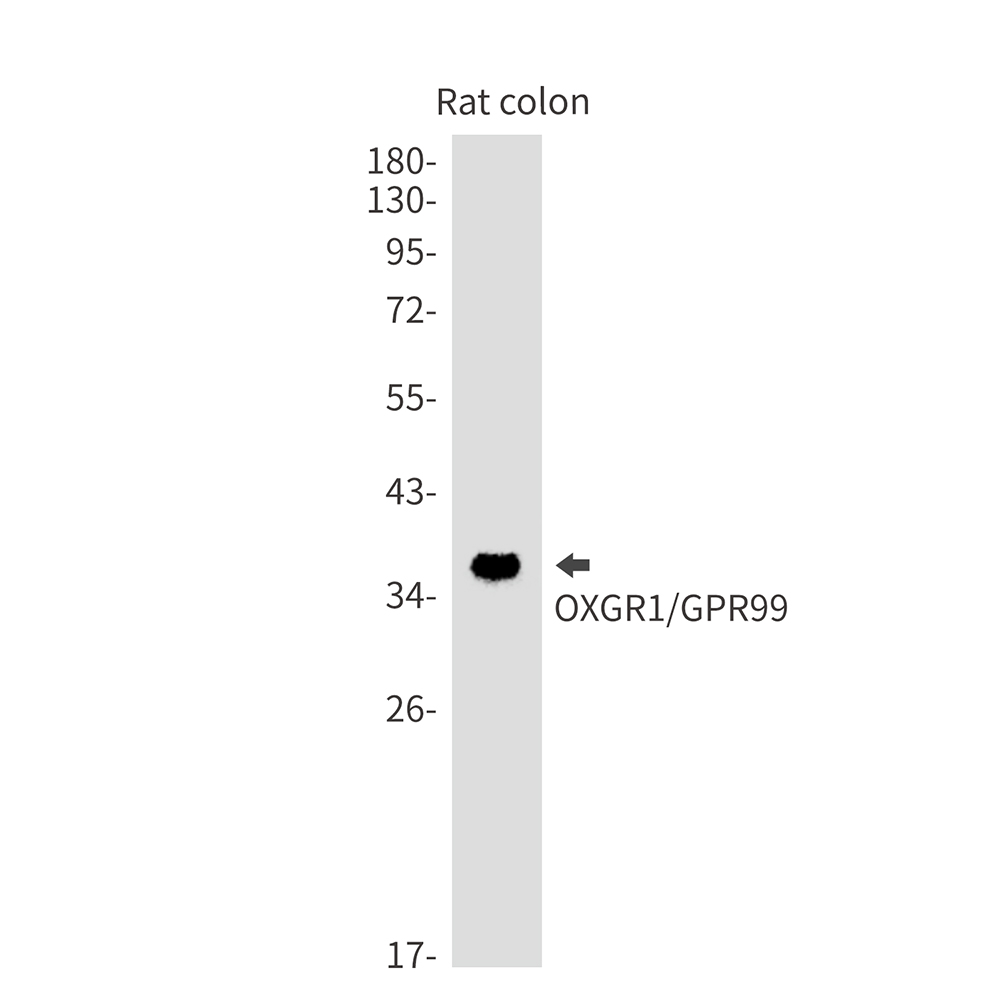 Rabbit Monoclonal Antibody to OXGR1