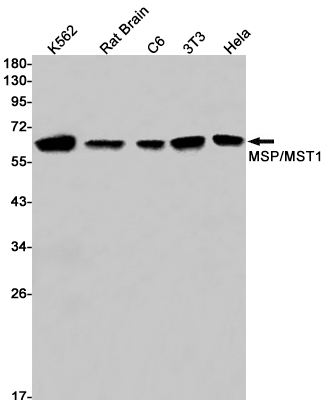 Rabbit Monoclonal Antibody to MSP