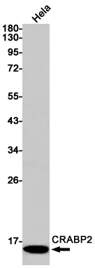 Rabbit Monoclonal Antibody to CRABP2