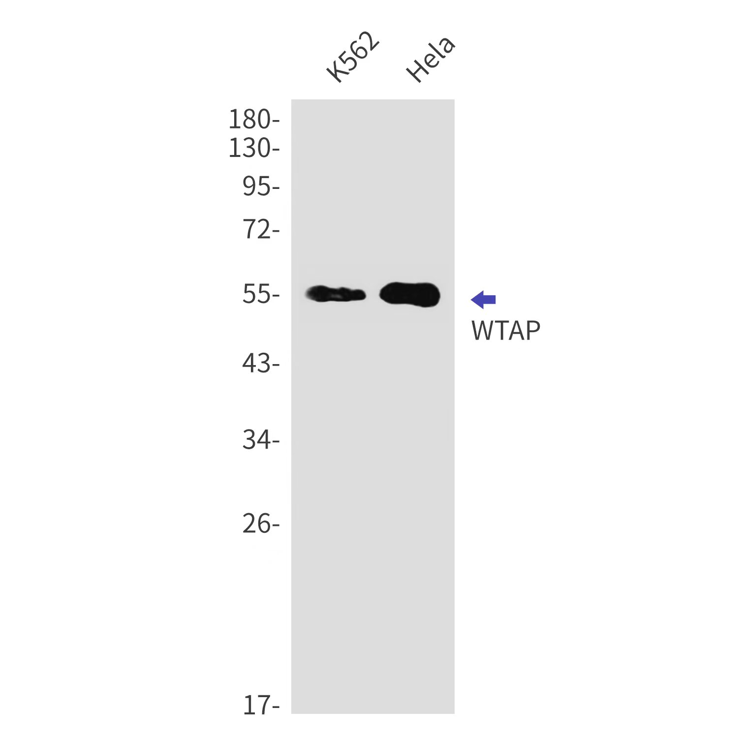 Rabbit Monoclonal Antibody to WTAP