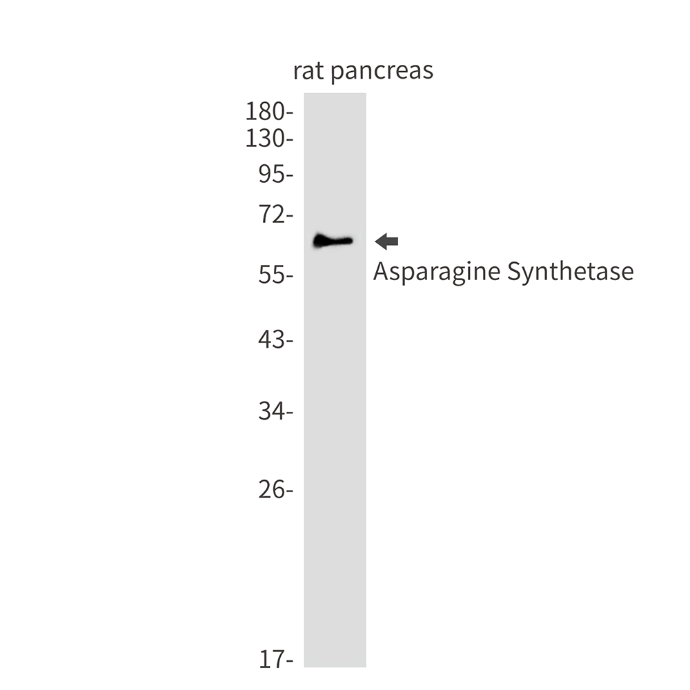 Rabbit Monoclonal Antibody to Asparagine Synthetase