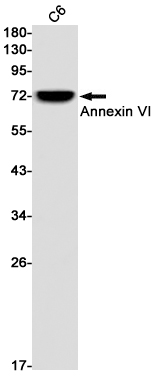 Rabbit Monoclonal Antibody to Annexin VI