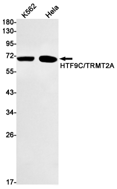 Rabbit Monoclonal Antibody to TRMT2A