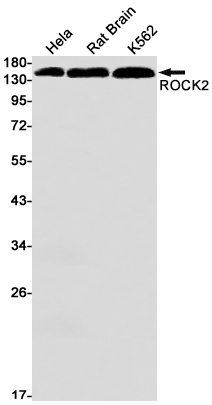 Rabbit Monoclonal Antibody to ROCK2
