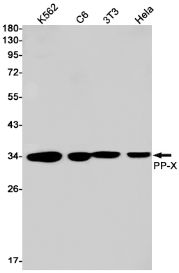 Rabbit Monoclonal Antibody to PPP4C