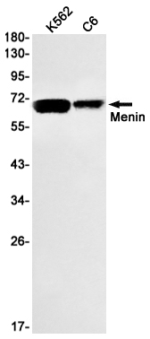 Rabbit Monoclonal Antibody to Menin