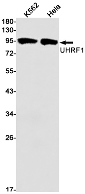Rabbit Monoclonal Antibody to UHRF1