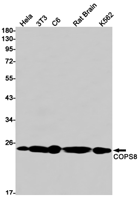 Rabbit Monoclonal Antibody to COPS8