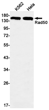Rabbit Monoclonal Antibody to Rad50