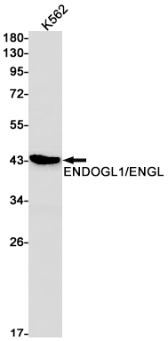 Rabbit Monoclonal Antibody to ENDOGL1