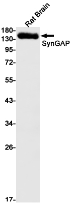 Rabbit Monoclonal Antibody to SynGAP