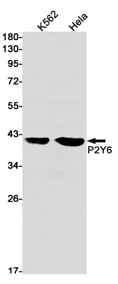Rabbit Monoclonal Antibody to P2Y6