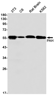 Rabbit Monoclonal Antibody to PAH