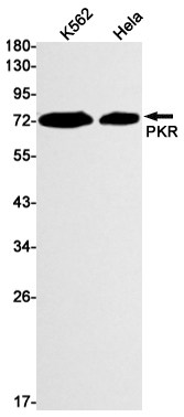 Rabbit Monoclonal Antibody to PKR