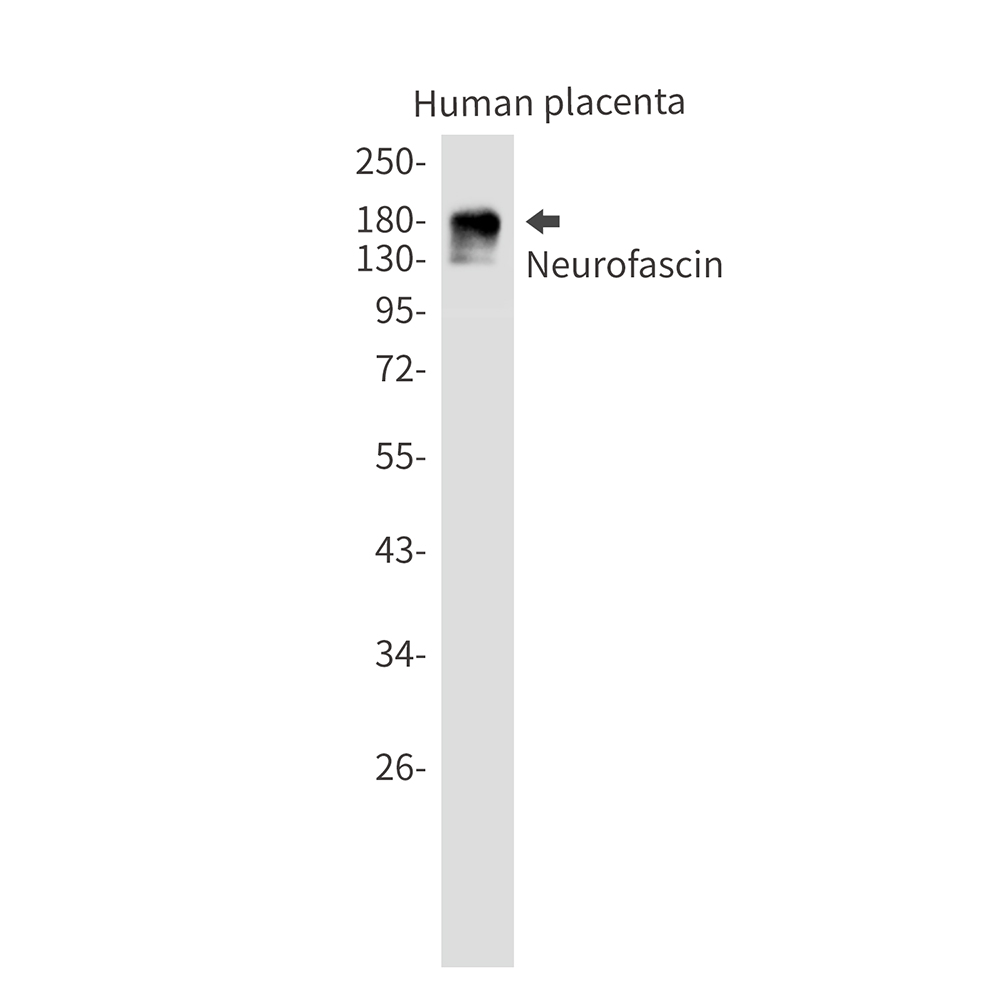 Rabbit Monoclonal Antibody to Neurofascin