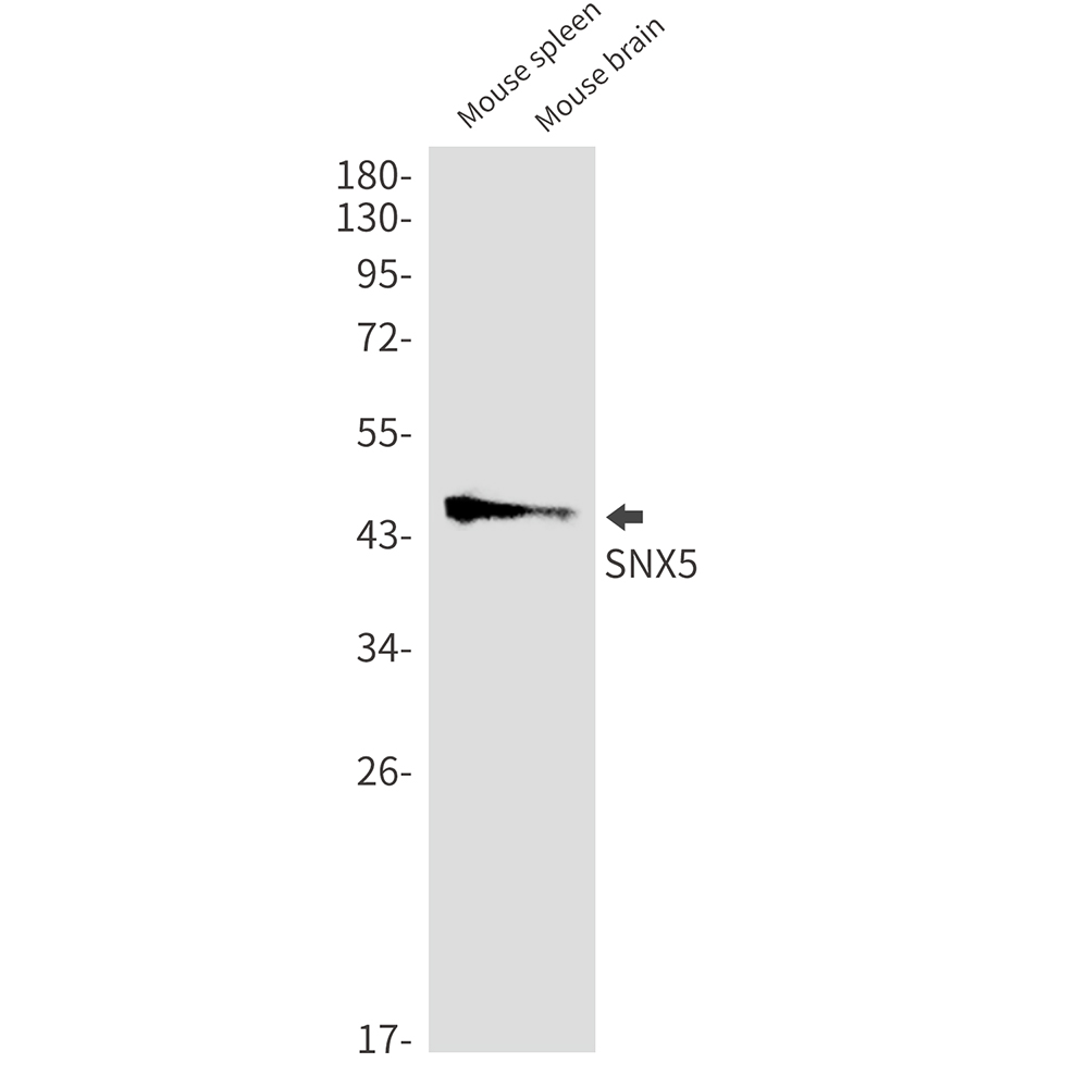 Rabbit Monoclonal Antibody to SNX5