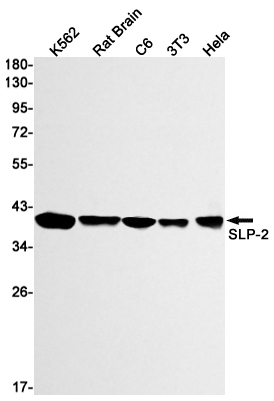 Rabbit Monoclonal Antibody to SLP2