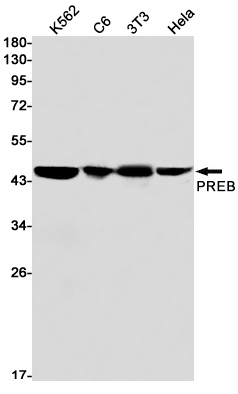 Rabbit Monoclonal Antibody to PREB