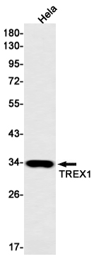 Rabbit Monoclonal Antibody to TREX1