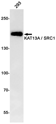 Rabbit Monoclonal Antibody to KAT13A