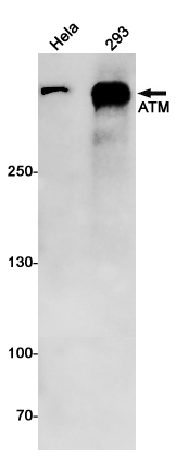Rabbit Monoclonal Antibody to ATM