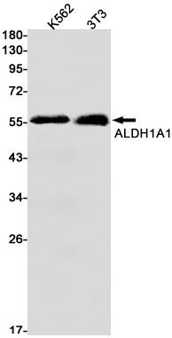 Rabbit Monoclonal Antibody to ALDH1A1