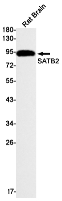 Rabbit Monoclonal Antibody to SATB2