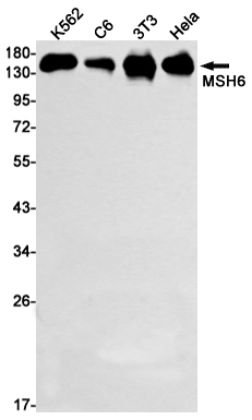 Rabbit Monoclonal Antibody to MSH6