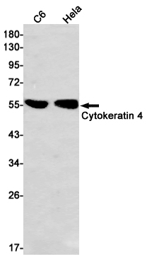 Rabbit Monoclonal Antibody to Cytokeratin 4