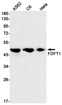Rabbit Monoclonal Antibody to FDFT1