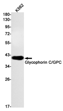 Rabbit Monoclonal Antibody to Glycophorin C