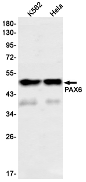 Rabbit Monoclonal Antibody to PAX6