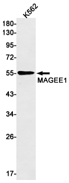 Rabbit Monoclonal Antibody to MAGEC2