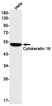 Rabbit Monoclonal Antibody to Cytokeratin 16